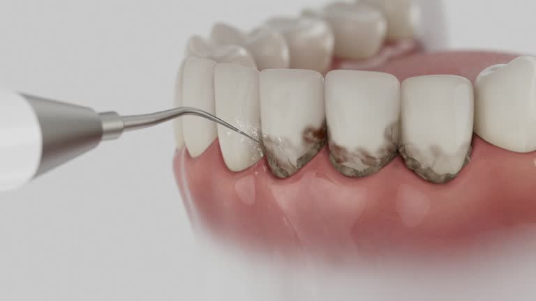 Reliable Dental Implants contractor in Newton County County, AR by Dentist Open Now